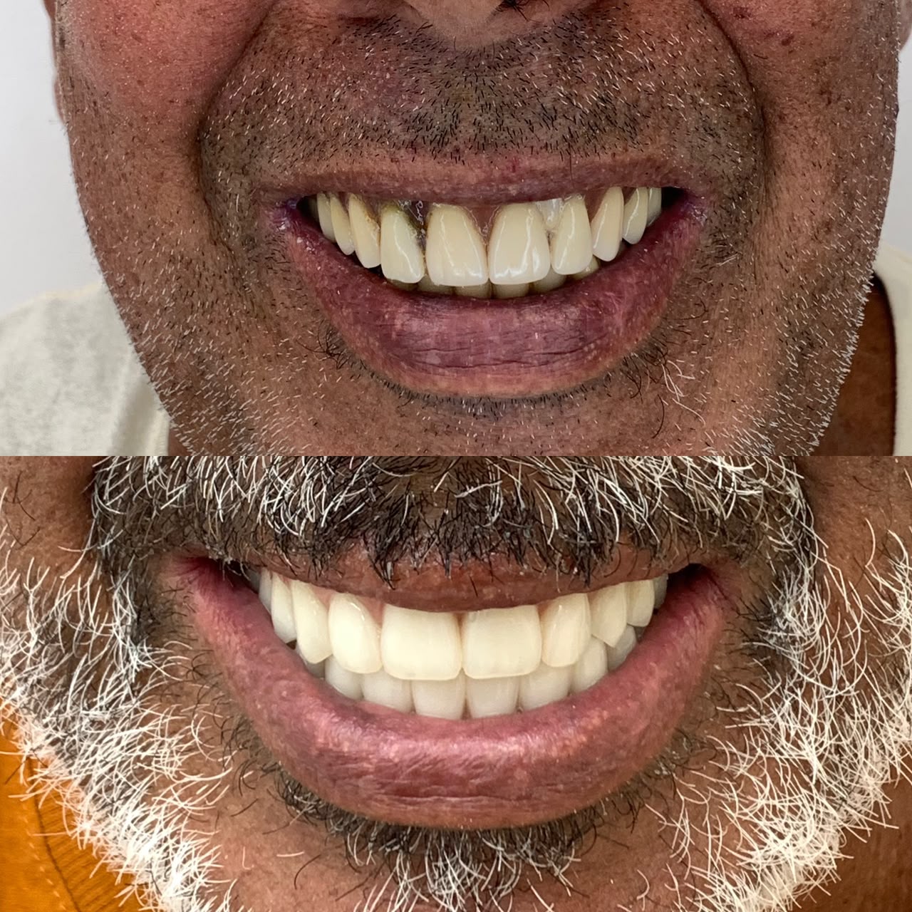 Caso antes e depois 5
