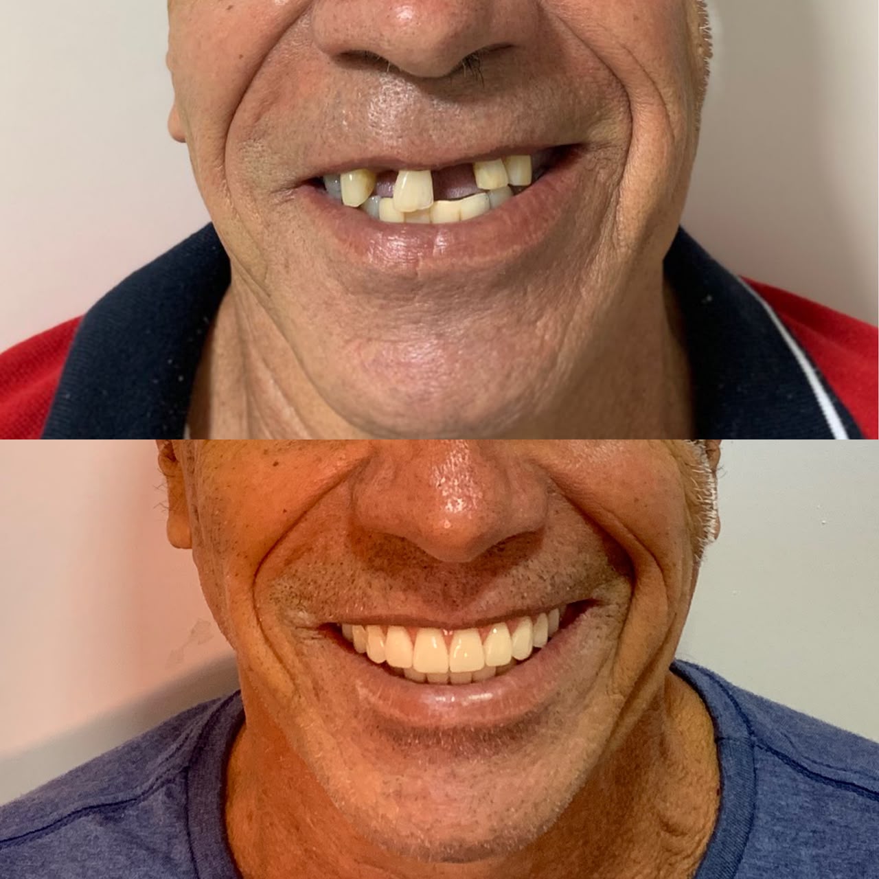Caso antes e depois 3