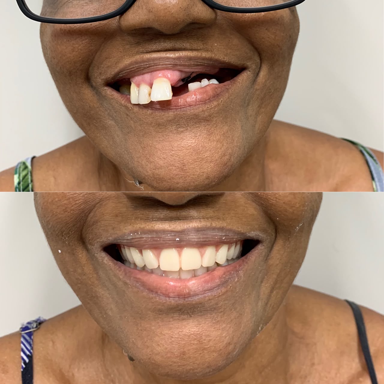 Caso antes e depois 2