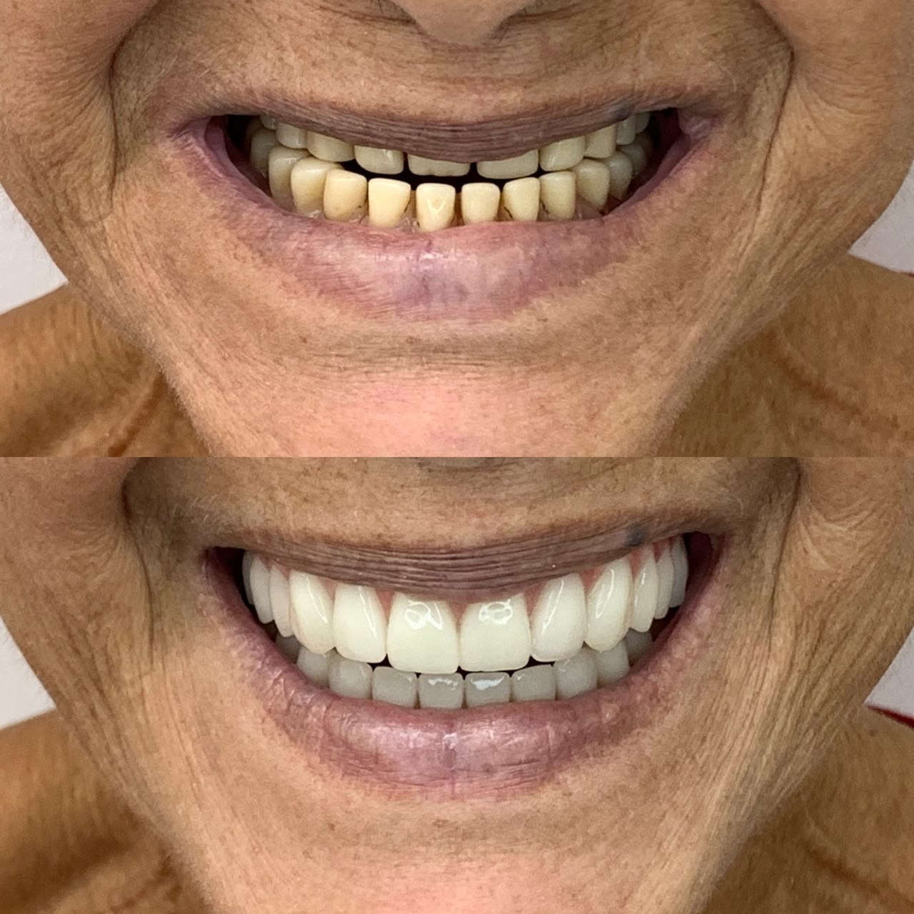 Caso antes e depois 9