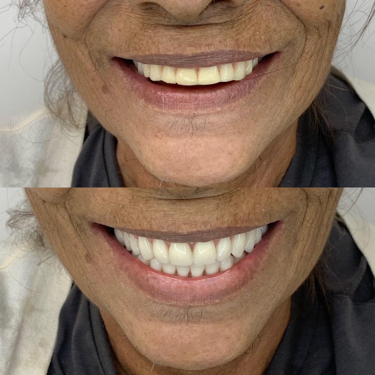 Caso antes e depois 1