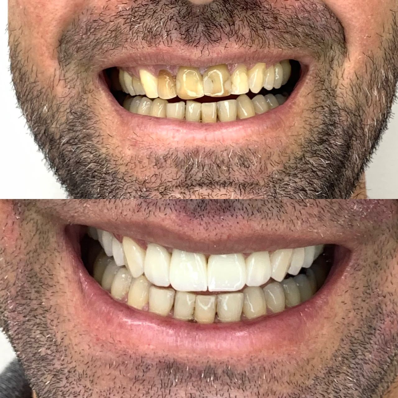 Caso antes e depois 6